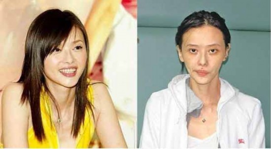吸毒让皮肤走向毁灭--陕西频道--人民网