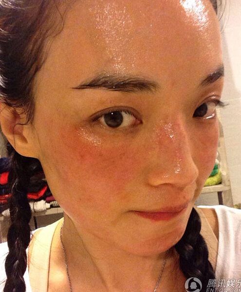 舒淇晒素颜照秀过敏红斑:有啥好在乎的(图)