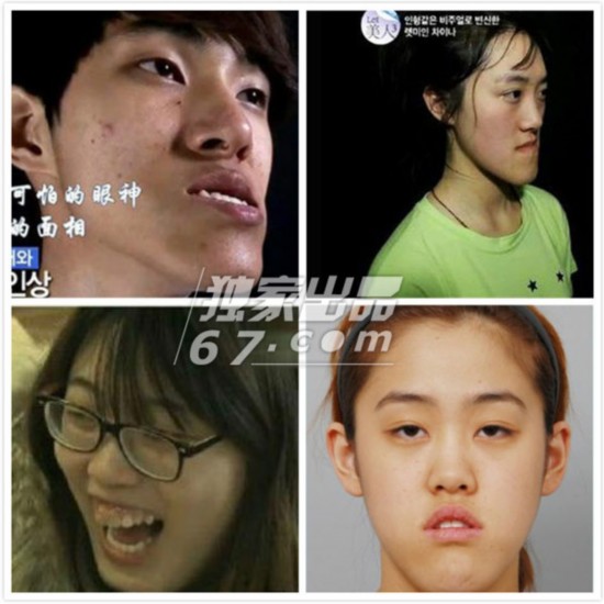 图揭韩国大尺度奇葩综艺秀:鞋拔子脸少女逆袭