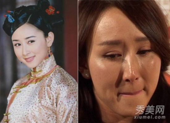 图揭娱乐圈12女星整容失败or早衰?【9】