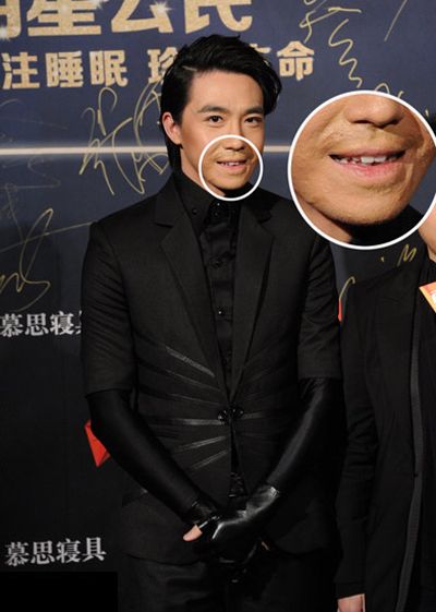 俞灏明自曝烧伤达深二度 不靠吸毒减压