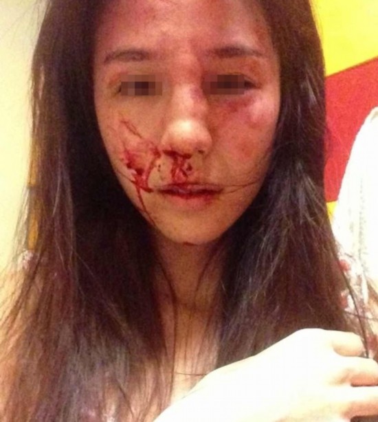 美女演员惨遇家暴 恐怖的体坛家暴盘点:AV女星