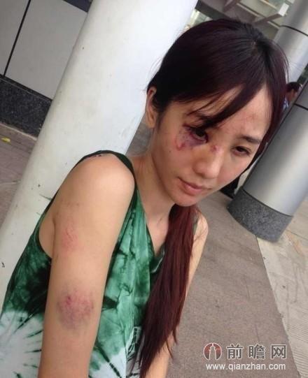 <em>女</em>演员被<em>家暴</em>头破血流 小章子怡童瑶黄奕<em>家暴</em>