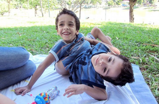 巴西5岁连体儿共用多个器官和生殖器 将接受分