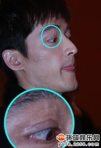 意外惨毁容的明星:俞灏明烧伤胡歌车祸(图)