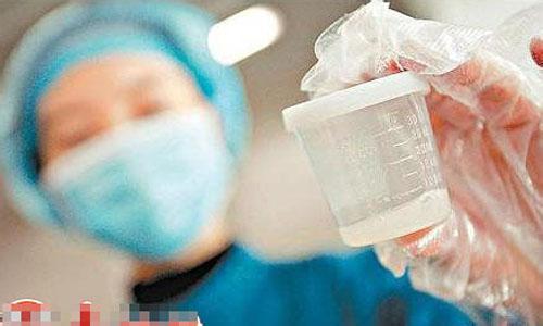 在读博士捐精死亡 解开有关捐精的3大问