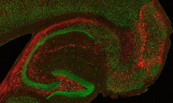 海马体照片什么意思 7046132288840758506.jpg