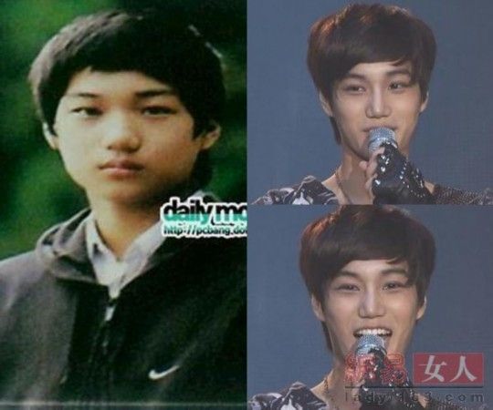 EXO出道前真容曝光:吴亦凡吴世勋土的错落有