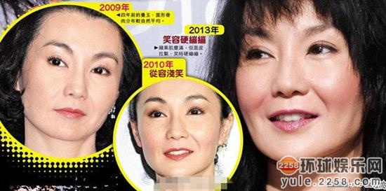 王菲张曼玉李小璐大S 揭秘女星打玻尿酸内幕