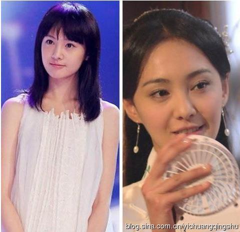十大整残女星：郑爽清纯变大众脸李小璐脸残现形