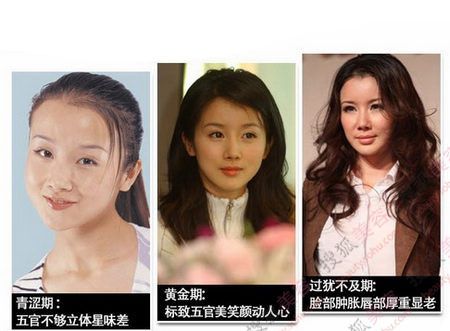 姚笛整容變臉似baby 揭女星整容部位