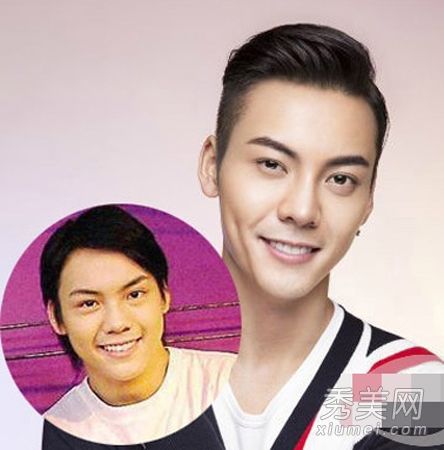 陈伟霆整容前后照片:与陈坤谢霆锋撞脸(图)--人