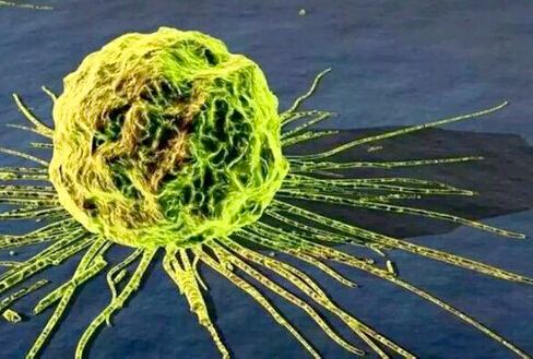 M1病毒抗癌细胞能以一敌千 M1能否颠覆癌症治