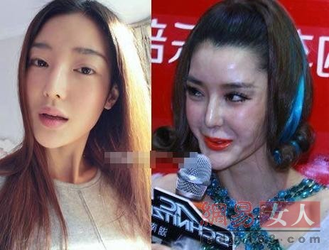 女神变女蛇精 angelababy郑爽领衔整容失败的女星【28】