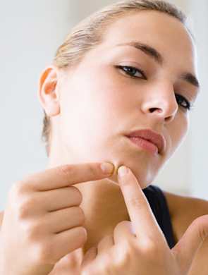 下巴长痘“对号入座”再处理