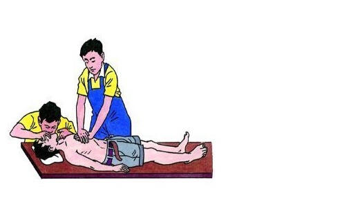 印尼17岁天才少女猝死 猝死的急救方法有哪些