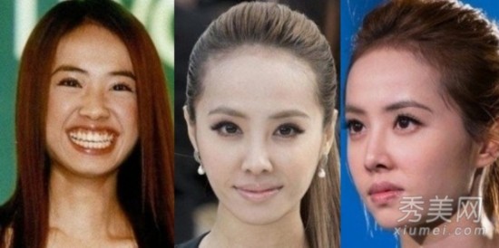 林青霞歪嘴王菲凸眼睛 图揭女星面部缺陷