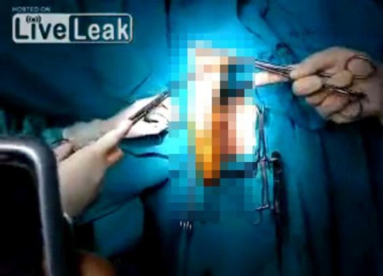 希腊男子被性玩具卡住肛门 做手术引医生围观