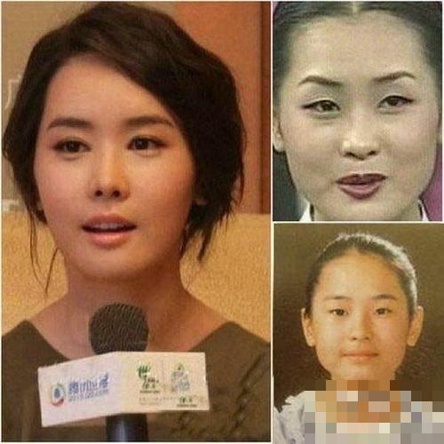 曝韩国女星整容变脸对比照：李多海尹恩惠变化惊人