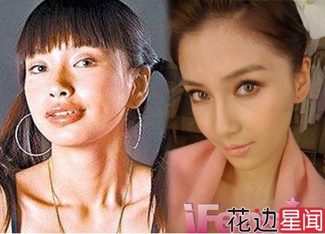 elaBaby首度承认整容 香肠嘴烂牙吓跑<em>黄晓明</em>【