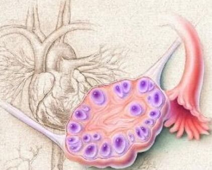 什么是畸胎瘤 畸胎瘤是怎么形成的?