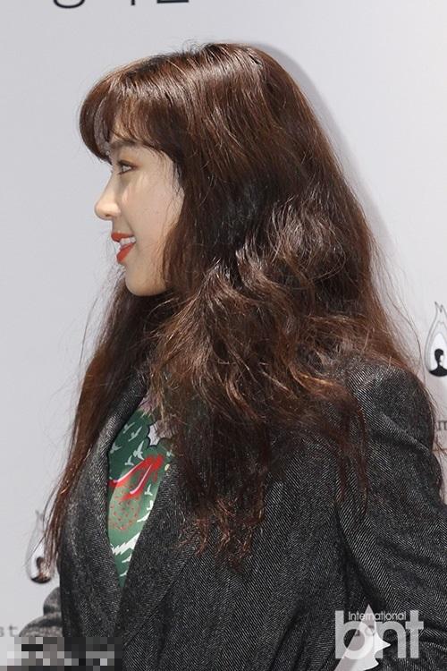 整容后遗症惊悚!韩星郑丽媛脸部严重扭曲 极速衰老似奶奶【12】--河南分网--人民网