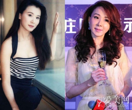  颜好也别太任性!整容变残跌落神坛的女星们 
