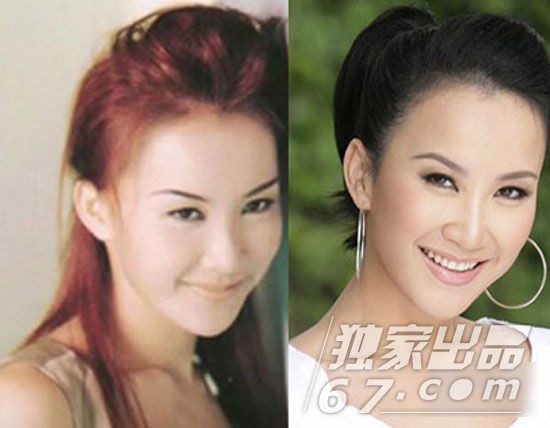 萧淑慎直播整形全程 那些承认整容的女星