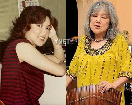 女星 返老还童 哪家强 针 女神不怕杀猪刀(图)