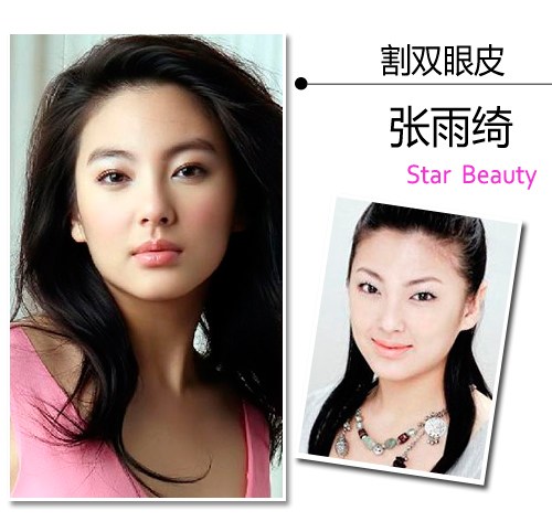 女星自曝修整部位:萧亚轩眼部<em>缝针</em> 郑爽动腮骨