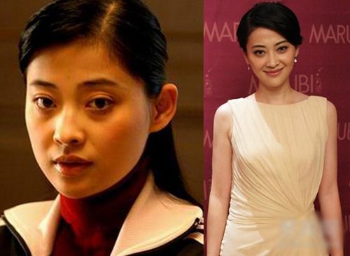 香肠嘴太吓人！全智贤今昔对比照 (图)