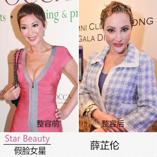 整容也有失手时 假脸军团变脸部位曝光