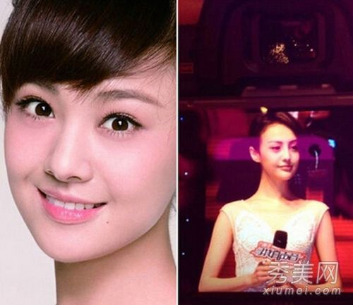 中韩女星整容失败案例:郑爽李多海《小苹果》