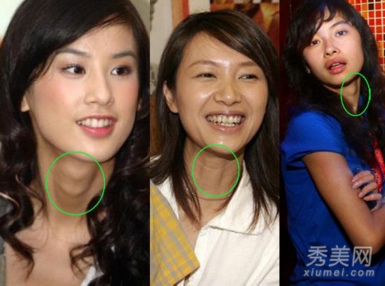 女明星致命缺陷:章子怡雀斑多张柏芝<em>平胸</em>Ange