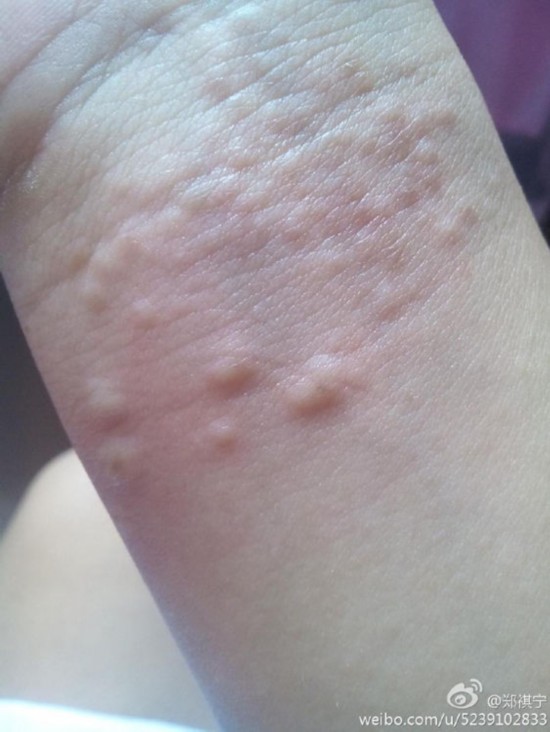 申花球员战怡麟网络直播自杀 盘点那些荒唐的