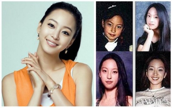 <em>韩艺瑟</em>整容变化惊人 盘点麻雀变凤凰的明星【