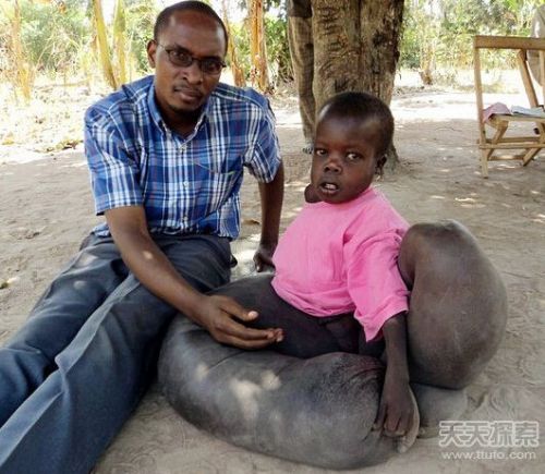 11岁女童拥有110岁身体 盘点各地奇人怪事