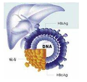 什么是爆发性乙肝 爆发性乙肝有什么症状