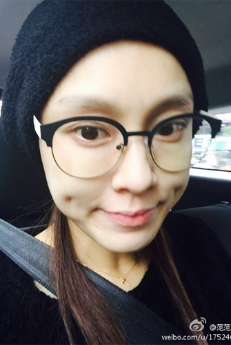 <em>范范</em>自拍<em>头发</em>稀少惹人疼 教你标本兼治增发量