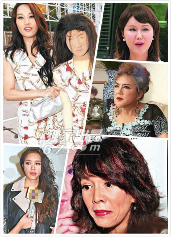TVB变脸陷面瘫危机：徐子珊胶面抢镜胡杏儿囧囧脸变V字