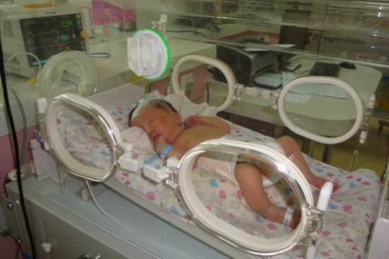 袖珍宝宝抢救成功渡过40天