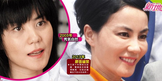 招聘整形医生_图刊 韩国美貌生产线