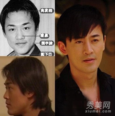 男星整容有的走红有的变残 图揭炎亚纶郑元畅变形记(图)