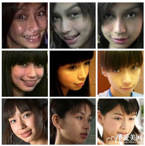 Angelababy整容前,整容最成功的明星 angelababy整容前后照片对比 深扒娱圈最成功的"变脸女王"