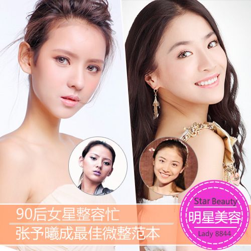 90后女星整容忙 张予曦成最佳微整范本