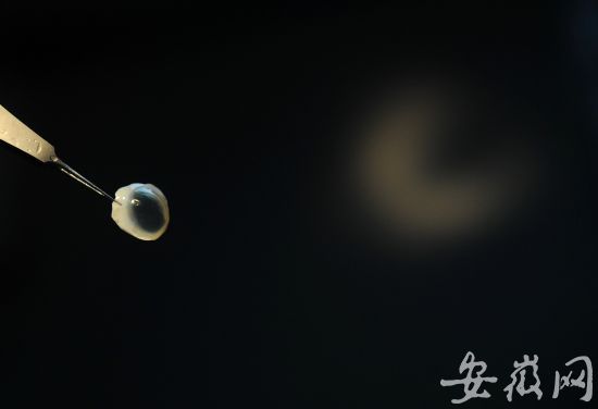 定远老师朱玉胜病逝捐出眼角膜 将能帮助两人