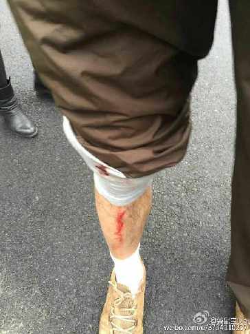 浙江金華萬達業主維權 集體下跪遭大批警察毆打