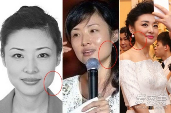 2015春晚女主持稀缺周涛疑整容 今昔对比