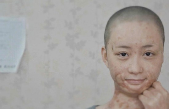 被官二代毁容少女索赔360余万元 在北京坐地铁被看哭