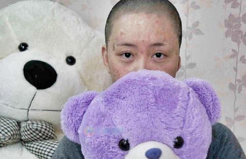 被官二代毁容少女索赔360余万 在北京坐地铁被